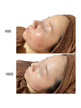 ヴィヴィエ 佐賀店(ViVier)/ララピール