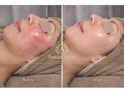 アンナカルナ(AnnaCarna)の写真