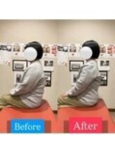 ナオル整体 宮崎院(NAORU整体)/30代女性施術事例【猫背改善】