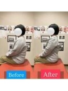 ナオル整体 宮崎院(NAORU整体)/30代女性施術事例【猫背改善】