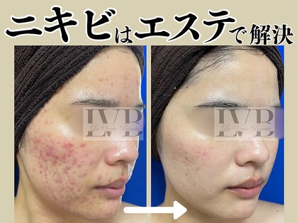 ラヴレボーテ(La Vraie Beaute)の写真