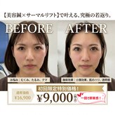 エスピーエー 桂坂(S.P.A)