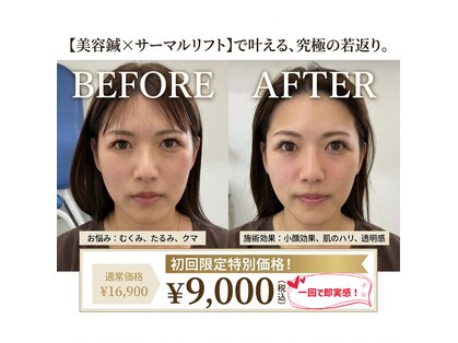 エスピーエー 桂坂(S.P.A)の写真