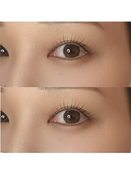 ケーオーエス ピンク(K O S Pink)/この夏限定！