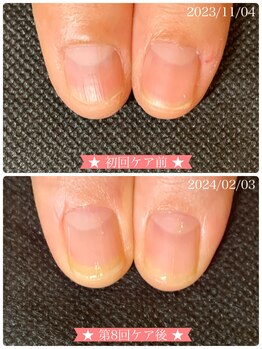 ネイルサロン ベルエトワール(belle etoile)/美爪育成ネイルケア3ヶ月コース