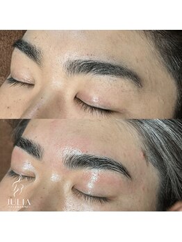 ジュリア(JULIA)/HBL（ハリウッドブロウリフト）