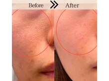 スリリアン 銀座/★お客さまビフォーアフター★