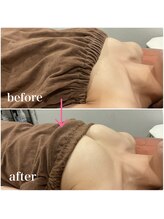 ロココ 大宮店(Rococo)/BカップからDカップへ