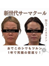 クリニカルボーテ 心斎橋院(CLINICAL BEAUTE)/必要な所へ脂肪コントロール