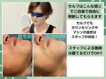 ワイズサロン(Y's salon)の雰囲気（スタッフによる施術、セルフ両対応&男女でお部屋、機械完全別♪）