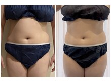 ディアウーマン(Dear Woman)/【4次元ボディメイキング】