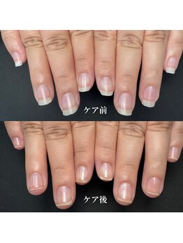 ココ(COCO)/ハンドケア・自爪育成・深爪育成