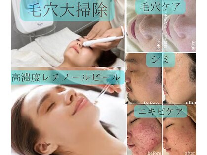 カラン(CALIN)の写真