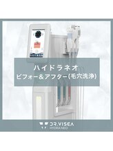 ソレヴィア(SOLEVIA)/【毛穴洗浄】ハイドラネオ