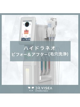ソレヴィア(SOLEVIA)/【毛穴洗浄】ハイドラネオ
