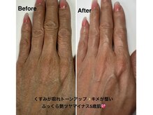 スクラブSPA＆パラフィンパックでモチモチマシュマロ色白肌に♪