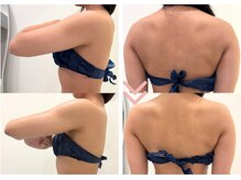 心地よい施術でブライダル痩身【麻布十番/痩身/ブライダル】