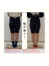 スタイルラボ高松/産後の骨盤矯正の効果♪