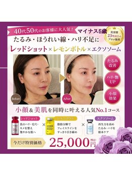 アン 銀座(ann)/【最強ケア】トリプルショット