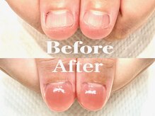 オー 町田モディ店(Oh!)/【スカルプ】深爪矯正育成♪春色