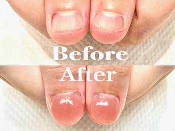 オー 町田モディ店(Oh!)/【スカルプ】深爪矯正育成♪春色