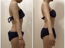 ルシエル ハカタ(Luciel HAKATA)/上半身痩身60分×2回(20代)