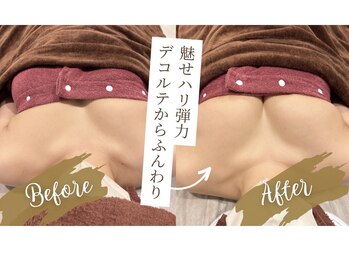 ブロッサム(blossom)