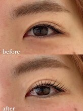 イーズ(ease.)/コスメリフト