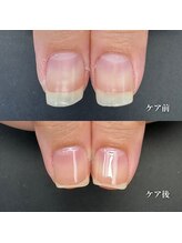 ココ(COCO)/ハンドケア・自爪育成・深爪育成