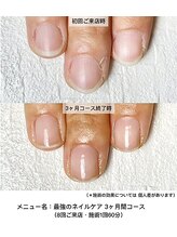 ネイルサロン ラピエトラ(la pietra)/最強のネイルケア３ケ月間コース