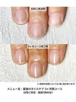 ネイルサロン ラピエトラ(la pietra)/最強のネイルケア3ケ月間コース