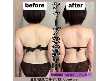 クチュール(couture.)/3回目after
