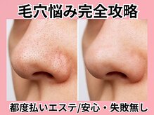 ルクス 新小岩店(Lux)の雰囲気（ピーリング、吸引、抗酸化でお肌ふっくら6600円～）