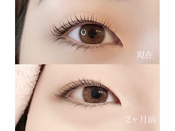 シャルム(Charme)/ラッシュアディクトの効果