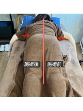 リアン(Liam)/美尻/美脚小尻/美容整体