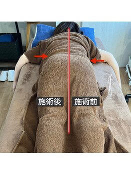 リアン(Liam)/美尻/美脚小尻/美容整体