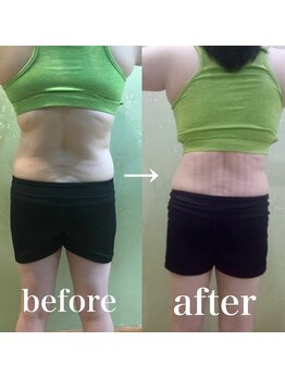 スパチャーレ(Spa ciare)/【トーンヌール】before&after