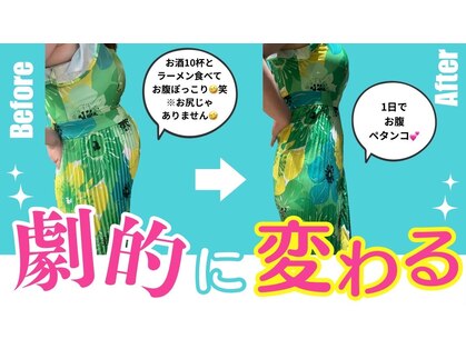 ヨサパーク ヒマワリ(YOSA PARK Himawari)の写真