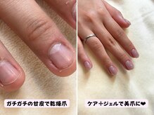 ココネイル(coco.nail)/