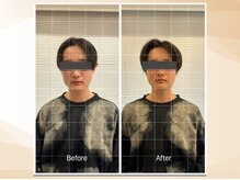 エモア メディカル整体院 恵比寿院(Emoa)/【20代男性】顔の施術