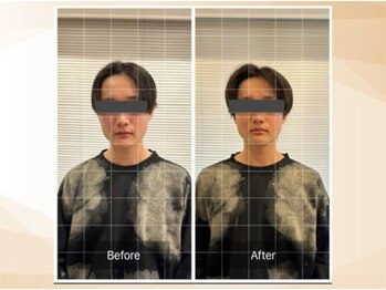 エモア メディカル整体院 恵比寿院(Emoa)/【20代男性】顔の施術
