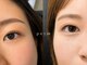 Moa 【モア】神戸/まつげパーマ/パリジェンヌ/マツエク/フラットラッシュの写真
