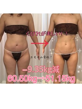 ボディエステティック アクアオーラ 富山店/くびれが美しい