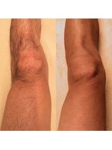 アヴィジョン(Avision)/