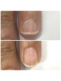WRネイルズ(WR Nails) 深爪や短いお爪でお悩みの方も自爪育成でここまで変わります。