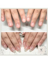 エヌスタイル(N-STYLE)/深爪改善ケア