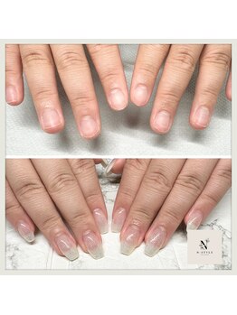 エヌスタイル(N-STYLE)/深爪改善ケア