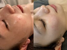ムーマイニー(m maini)の雰囲気（当サロンだけでの変化。普通肌をワンランク上の圧倒的美肌に！）