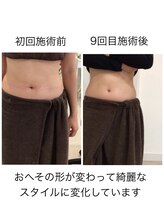 ジョワイユ(Joyeux)/腸の位置でお腹は変わる