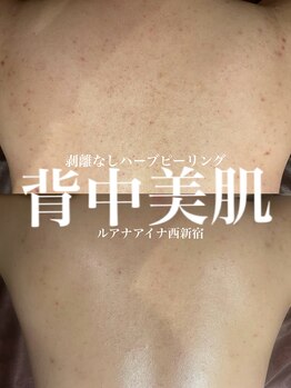 ルアナアイナ(Luana Aina)/背中ケア/ハーブピーリング